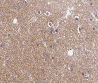 GNAZ Antibody - 1:200 staining human brain tissue by IHC-P. The tissue was formaldehyde fixed and a heat mediated antigen retrieval step in citrate buffer was performed. The tissue was then blocked and incubated with the antibody for 1.5 hours at 22°C. An HRP conjugated goat anti-rabbit antibody was used as the secondary.