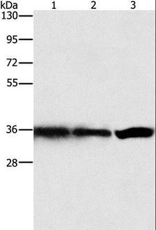 GNB1 Antibody - Western blot analysis of HeLa, 293T and 231 cell, using GNB1 Polyclonal Antibody at dilution of 1:450.