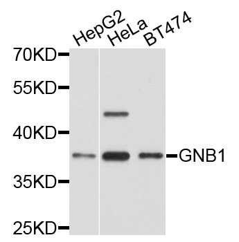 GNB1 Antibody - Western blot analysis of extracts of various cells.