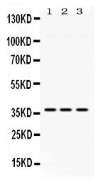 GNB1 Antibody - Western blot analysis of GNB1 using anti-GNB1 antibody. Electrophoresis was performed on a 5-20% SDS-PAGE gel at 70V (Stacking gel) / 90V (Resolving gel) for 2-3 hours. The sample well of each lane was loaded with 50ug of sample under reducing conditions. Lane 1: rat liver tissue lysates, Lane 2: mouse cardiac muscle tissue lysates, Lane 3: HELA whole cell lysates. After Electrophoresis, proteins were transferred to a Nitrocellulose membrane at 150mA for 50-90 minutes. Blocked the membrane with 5% Non-fat Milk/ TBS for 1.5 hour at RT. The membrane was incubated with rabbit anti-GNB1 antigen affinity purified polyclonal antibody at 0.5 µg/mL overnight at 4°C, then washed with TBS-0.1% Tween 3 times with 5 minutes each and probed with a goat anti-rabbit IgG-HRP secondary antibody at a dilution of 1:10000 for 1.5 hour at RT. The signal is developed using an Enhanced Chemiluminescent detection (ECL) kit with Tanon 5200 system. A specific band was detected for GNB1 at approximately 37KD. The expected band size for GNB1 is at 37KD.
