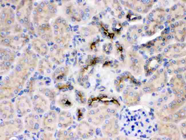 GNB1 Antibody - IHC analysis of GNB1 using anti-GNB1 antibody. GNB1 was detected in paraffin-embedded section of rat kidney tissue. Heat mediated antigen retrieval was performed in citrate buffer (pH6, epitope retrieval solution) for 20 mins. The tissue section was blocked with 10% goat serum. The tissue section was then incubated with 1µg/ml rabbit anti-GNB1 Antibody overnight at 4°C. Biotinylated goat anti-rabbit IgG was used as secondary antibody and incubated for 30 minutes at 37°C. The tissue section was developed using Strepavidin-Biotin-Complex (SABC) with DAB as the chromogen.