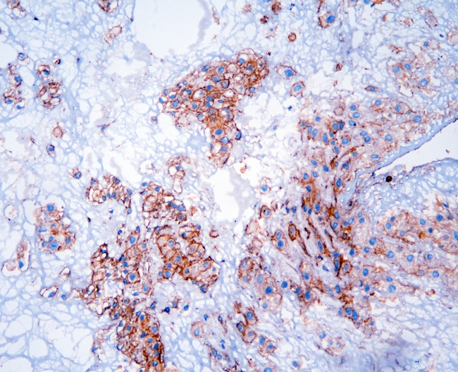 GNB1 Antibody - IHC analysis of GNB1 using anti-GNB1 antibody. GNB1 was detected in frozen section of human placenta tissue. Heat mediated antigen retrieval was performed in citrate buffer (pH6, epitope retrieval solution) for 20 mins. The tissue section was blocked with 10% goat serum. The tissue section was then incubated with 1µg/ml rabbit anti-GNB1 Antibody overnight at 4°C. Biotinylated goat anti-rabbit IgG was used as secondary antibody and incubated for 30 minutes at 37°C. The tissue section was developed using Strepavidin-Biotin-Complex (SABC) with DAB as the chromogen.