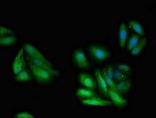 GNB1 Antibody - Immunofluorescent analysis of HepG2 cells diluted at 1:100 and Alexa Fluor 488-congugated AffiniPure Goat Anti-Rabbit IgG(H+L)