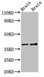 GNB1 Antibody - Western Blot Positive WB detected in:Rat brain tissue,Mouse brain tissue All Lanes:GNB1 antibody at 3µg/ml Secondary Goat polyclonal to rabbit IgG at 1/50000 dilution Predicted band size: 38,37 KDa Observed band size: 38 KDa