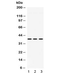 GNB1 Antibody - Western blot testing of 1) rat liver, 2) mouse heart and 3) human HeLa lysate with GNB1 antibody at 0.5ug/ml. Predicted/observed molecular weight: ~37 kDa.