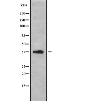 GNB1 Antibody - Western blot analysis GNB1 using HeLa whole cells lysates