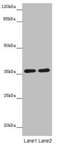 GNB1L / FKSG1 Antibody - Western blot All Lanes: GNB1L antibody at 3.69 ug/ml Lane 1: Mouse brain tissue Lane 2: Jurkat whole cell lysate Secondary Goat polyclonal to rabbit IgG at 1/10000 dilution Predicted band size: 36,23 kDa Observed band size: 36 kDa