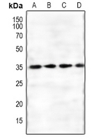 GNB1L / FKSG1 Antibody - Western blot analysis of FKSG1 expression in mouse kidney (A), rat kidney (B), mouse heart (C), rat heart (D) whole cell lysates.