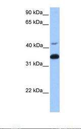 GNB2 Antibody - Fetal brain lysate. Antibody concentration: 1.0 ug/ml. Gel concentration: 12%.  This image was taken for the unconjugated form of this product. Other forms have not been tested.