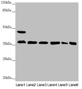 GNB2 Antibody - Western blot All Lanes:GNB2 antibody at 2.22 ug/ml Lane 1: Mouse liver tissue Lane 2: Mouse lung tissue Lane 3: NIH/3T3 whole cell lysate Lane 4: Jurkat whole cell lysate Lane 5: 293T whole cell lysate Lane 6: Hela whole cell lysate Secondary Goat polyclonal to rabbit IgG at 1/10000 dilution Predicted band size: 38,26 kDa Observed band size: 37,45 kDa