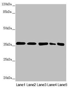 GNB2 Antibody - Western blot All lanes: GNB2 antibody at 2.22µg/ml Lane 1: Mouse lung tissue Lane 2: NIH/3T3 whole cell lysate Lane 3: Jurkat whole cell lysate Lane 4: 293T whole cell lysate Lane 5: Hela whole cell lysate Secondary Goat polyclonal to rabbit IgG at 1/10000 dilution Predicted band size: 38, 26 kDa Observed band size: 38 kDa