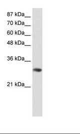 GNB2L1 / RACK1 Antibody - Jurkat Cell Lysate.  This image was taken for the unconjugated form of this product. Other forms have not been tested.