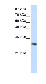 GNB2L1 / RACK1 Antibody - GNB2L1 / RACK1 antibody Western blot of Jurkat lysate. This image was taken for the unconjugated form of this product. Other forms have not been tested.
