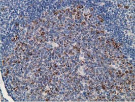 GNB2L1 / RACK1 Antibody - IHC of paraffin-embedded Human lymph node tissue using anti-GNB2L1 mouse monoclonal antibody. (Heat-induced epitope retrieval by 10mM citric buffer, pH6.0, 100C for 10min).