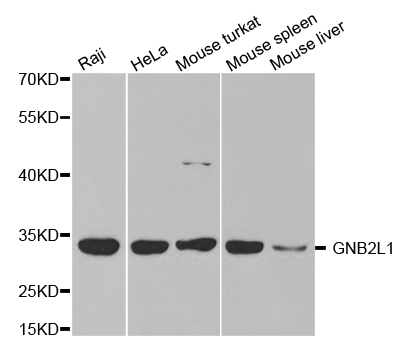 GNB2L1 / RACK1 Antibody - Western blot analysis of extracts of various cell lines.