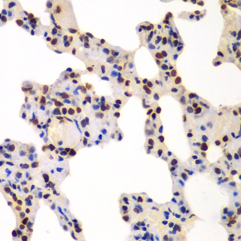 GNB2L1 / RACK1 Antibody - Immunohistochemistry of paraffin-embedded rat lung tissue.