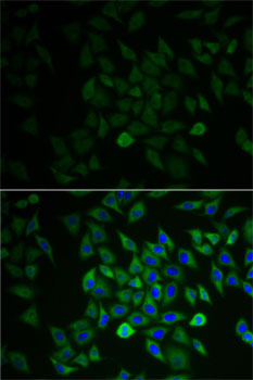 GNB2L1 / RACK1 Antibody - Immunofluorescence analysis of A-549 cells using GNB2L1 antibody. Blue: DAPI for nuclear staining.