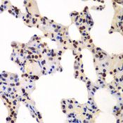 GNB2L1 / RACK1 Antibody - Immunohistochemistry of paraffin-embedded rat lung using GNB2L1 antibody at dilution of 1:100 (40x lens).