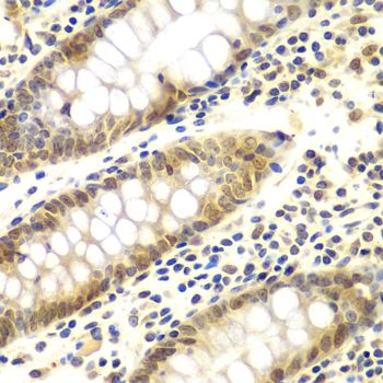 GNB2L1 / RACK1 Antibody - Immunohistochemistry of paraffin-embedded human colon using GNB2L1 antibody at dilution of 1:100 (40x lens).