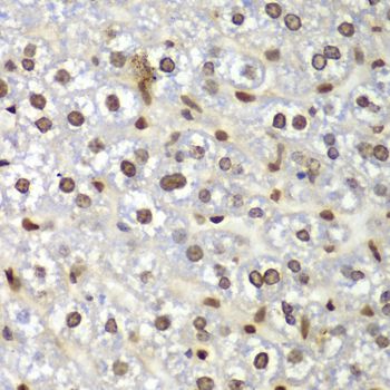 GNB2L1 / RACK1 Antibody - Immunohistochemistry of paraffin-embedded mouse liver using GNB2L1 antibody at dilution of 1:100 (40x lens).