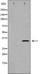 GNB2L1 / RACK1 Antibody - Western blot analysis of HeLa whole cells lysates using GNB2L1 antibody. The lane on the left is treated with the antigen-specific peptide.