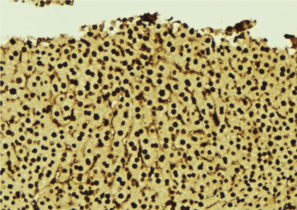GNB2L1 / RACK1 Antibody - 1:100 staining mouse liver tissue by IHC-P. The sample was formaldehyde fixed and a heat mediated antigen retrieval step in citrate buffer was performed. The sample was then blocked and incubated with the antibody for 1.5 hours at 22°C. An HRP conjugated goat anti-rabbit antibody was used as the secondary.