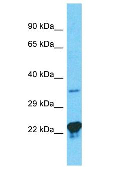 GNB3 Antibody - GNB3 antibody Western Blot of Jurkat. Antibody dilution: 1 ug/ml.  This image was taken for the unconjugated form of this product. Other forms have not been tested.