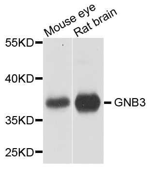GNB3 Antibody - Western blot analysis of extracts of various cell lines, using GNB3 antibody at 1:1000 dilution. The secondary antibody used was an HRP Goat Anti-Rabbit IgG (H+L) at 1:10000 dilution. Lysates were loaded 25ug per lane and 3% nonfat dry milk in TBST was used for blocking. An ECL Kit was used for detection and the exposure time was 5s.