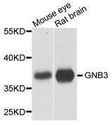 GNB3 Antibody - Western blot analysis of extracts of various cell lines, using GNB3 antibody at 1:1000 dilution. The secondary antibody used was an HRP Goat Anti-Rabbit IgG (H+L) at 1:10000 dilution. Lysates were loaded 25ug per lane and 3% nonfat dry milk in TBST was used for blocking. An ECL Kit was used for detection and the exposure time was 5s.