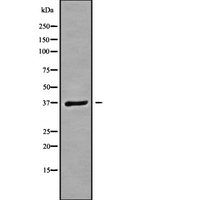 GNB3 Antibody - Western blot analysis GNB3 using A549 whole cells lysates