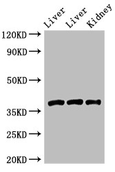GNB4 Antibody - Positive WB detected in:Rat liver tissue,Mouse liver tissue,Mouse kidney tissue;All lanes:GNB4 antibody at 2?g/ml;Secondary;Goat polyclonal to rabbit IgG at 1/50000 dilution;Predicted band size: 38 KDa;Observed band size: 38 KDa;