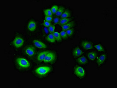 GNG10 Antibody - Immunofluorescent analysis of A549 cells using GNG10 Antibody at dilution of 1:100 and Alexa Fluor 488-congugated AffiniPure Goat Anti-Rabbit IgG(H+L)