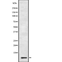 GNG10 Antibody - Western blot analysis of GNG10 expression in HepG2 cells lysate. The lane on the left is treated with the antigen-specific peptide.