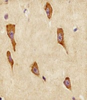 GNG12 Antibody - Antibody staining GNG12 in human brain tissue sections by Immunohistochemistry (IHC-P - paraformaldehyde-fixed, paraffin-embedded sections). Tissue was fixed with formaldehyde and blocked with 3% BSA for 0. 5 hour at room temperature; antigen retrieval was by heat mediation with a citrate buffer (pH 6). Samples were incubated with primary antibody (1:25) for 1 hours at 37°C. A undiluted biotinylated goat polyvalent antibody was used as the secondary antibody.