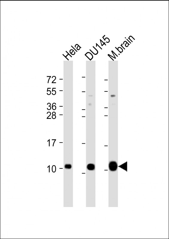 GNG12 Antibody - All lanes: Anti-GNG12 Antibody (C-Term) at 1:2000 dilution. Lane 1: HeLa whole cell lysate. Lane 2: DU145 whole cell lysate. Lane 3: mouse brain lysate Lysates/proteins at 20 ug per lane. Secondary Goat Anti-Rabbit IgG, (H+L), Peroxidase conjugated at 1:10000 dilution. Predicted band size: 8 kDa. Blocking/Dilution buffer: 5% NFDM/TBST.