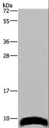 GNG2 Antibody - Western blot analysis of Mouse paranephros tissue, using GNG2 Polyclonal Antibody at dilution of 1:300.