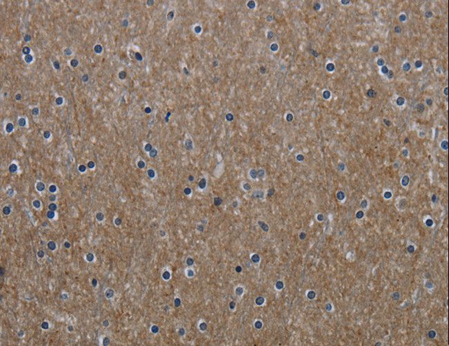 GNG2 Antibody - Immunohistochemistry of paraffin-embedded Human brain using GNG2 Polyclonal Antibody at dilution of 1:60.