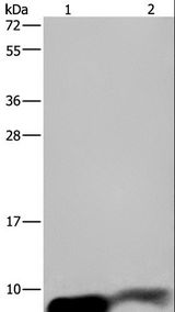 GNG2 Antibody - Western blot analysis of Human fetal brain and mouse brain tissue, using GNG2 Polyclonal Antibody at dilution of 1:350.