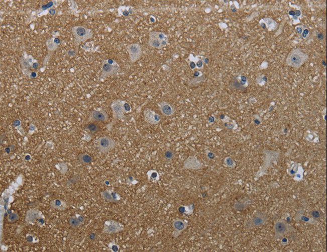 GNG2 Antibody - Immunohistochemistry of paraffin-embedded Human brain using GNG2 Polyclonal Antibody at dilution of 1:50.