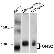 GNG2 Antibody - Western blot analysis of extracts of various cell lines, using GNG2 antibody at 1:1000 dilution. The secondary antibody used was an HRP Goat Anti-Rabbit IgG (H+L) at 1:10000 dilution. Lysates were loaded 25ug per lane and 3% nonfat dry milk in TBST was used for blocking. An ECL Kit was used for detection and the exposure time was 30s.