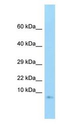 GNG3 Antibody - GNG3 antibody Western Blot of Fetal Brain.  This image was taken for the unconjugated form of this product. Other forms have not been tested.