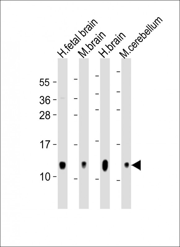 GNG3 Antibody - All lanes: Anti-GNG3 Antibody (C-Term) at 1:2000 dilution Lane 1: human fetal brain lysate Lane 2: mouse brain lysate Lane 3: human brain lysate Lane 4: mouse cerebellum lysate Lysates/proteins at 20 µg per lane. Secondary Goat Anti-Rabbit IgG, (H+L), Peroxidase conjugated at 1/10000 dilution. Predicted band size: 8 kDa Blocking/Dilution buffer: 5% NFDM/TBST.