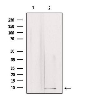 GNG3 Antibody - Western blot analysis of extracts of rat brain tissue using GNG3 antibody. Lane 1 was treated with the blocking peptide.