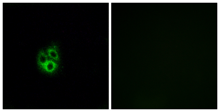 GNG5 Antibody - Immunofluorescence analysis of A549 cells, using GNG5 Antibody. The picture on the right is blocked with the synthesized peptide.