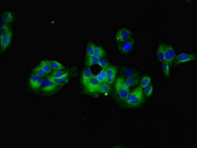 GNG5 Antibody - Immunofluorescent analysis of PC-3 cells using GNG5 Antibody at dilution of 1:100 and Alexa Fluor 488-congugated AffiniPure Goat Anti-Rabbit IgG(H+L)