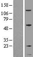 GNG5 Protein - Western validation with an anti-DDK antibody * L: Control HEK293 lysate R: Over-expression lysate