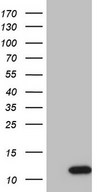GNG7 Antibody - HEK293T cells were transfected with the pCMV6-ENTRY control. (Left lane) or pCMV6-ENTRY GNG7. (Right lane) cDNA for 48 hrs and lysed