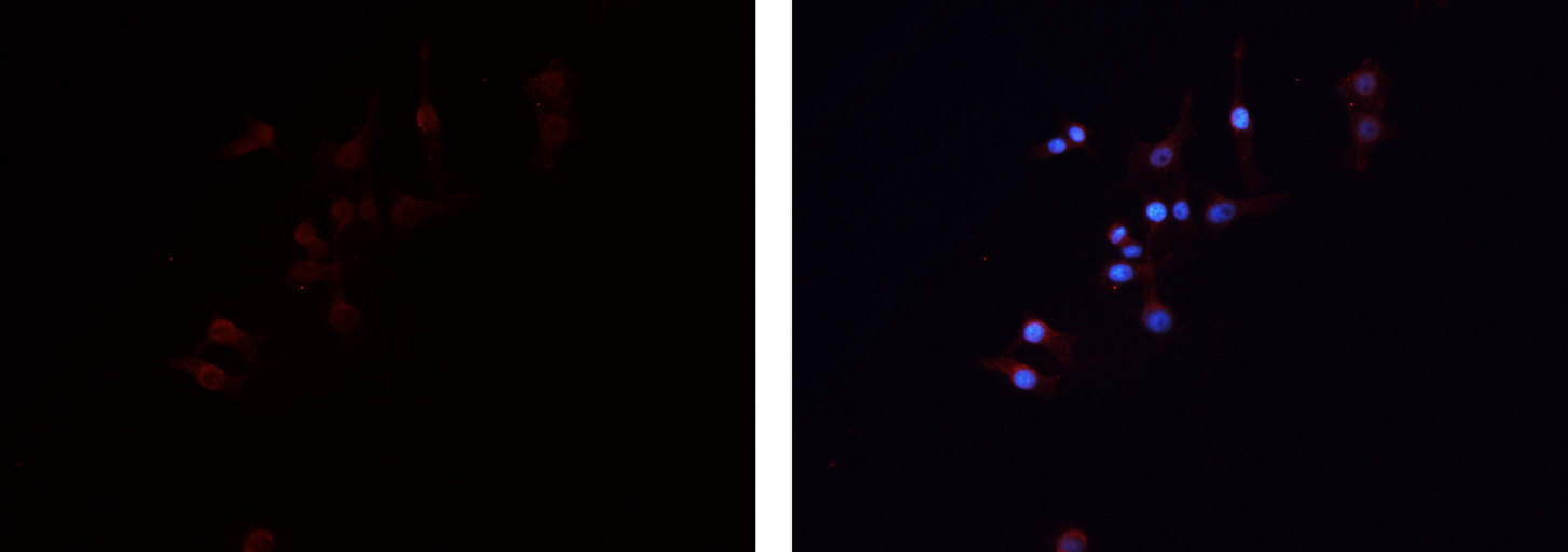 GNG7 Antibody - Staining HepG2 cells by IF/ICC. The samples were fixed with PFA and permeabilized in 0.1% Triton X-100, then blocked in 10% serum for 45 min at 25°C. The primary antibody was diluted at 1:200 and incubated with the sample for 1 hour at 37°C. An Alexa Fluor 594 conjugated goat anti-rabbit IgG (H+L) antibody, diluted at 1/600 was used as secondary antibody.