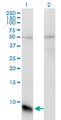 GNGT1 Antibody - Western Blot analysis of GNGT1 expression in transfected 293T cell line by GNGT1 monoclonal antibody (M01), clone 1F8.Lane 1: GNGT1 transfected lysate(8.5 KDa).Lane 2: Non-transfected lysate.