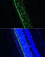 GNGT1 Antibody - Immunofluorescence analysis of Rat eye using GNGT1 Polyclonal Antibody at dilution of 1:100 (40x lens).Blue: DAPI for nuclear staining.